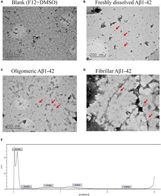 Effects of α-Lipoic Acid on Phagocytosis of Oligomeric Beta-Amyloid1–42 in BV-2 Mouse Microglial Cells